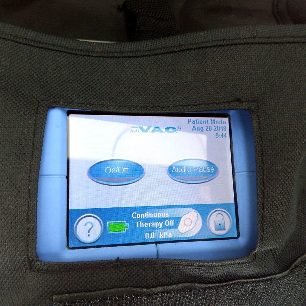 KCI ACTIVAC ACTI VAC Negative Pressure Wound Healing Device Patient